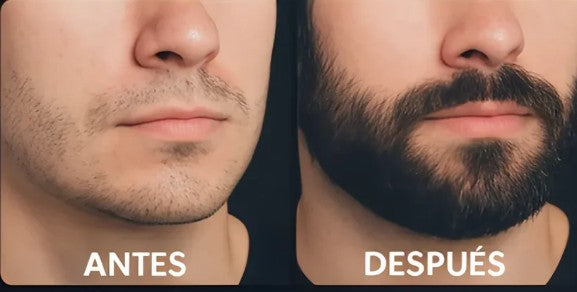 Serum Premium Para crecimiento de Barba