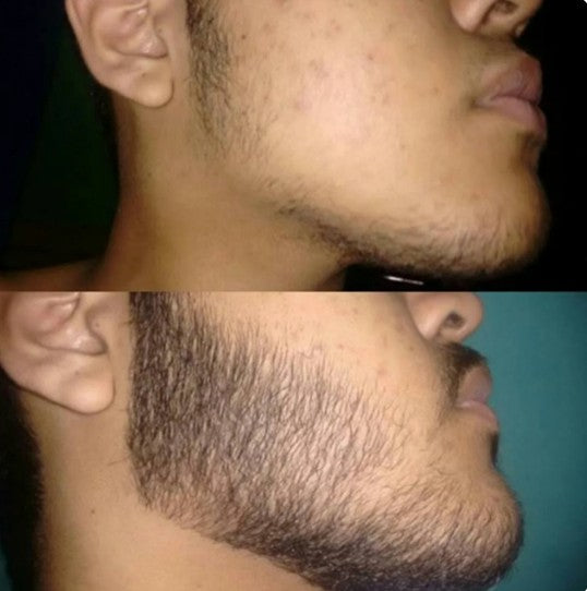 Serum Premium Para crecimiento de Barba