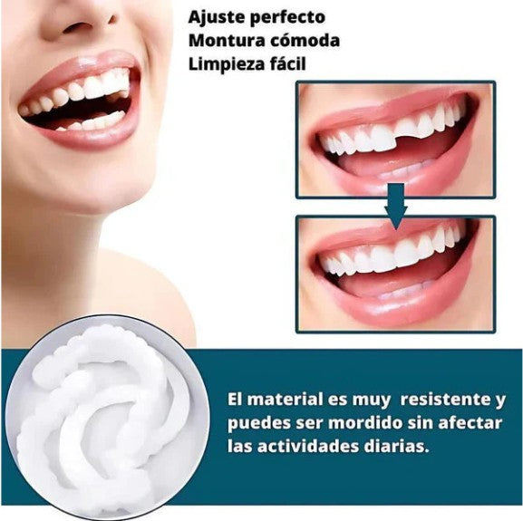 CARILLAS DENTALES
