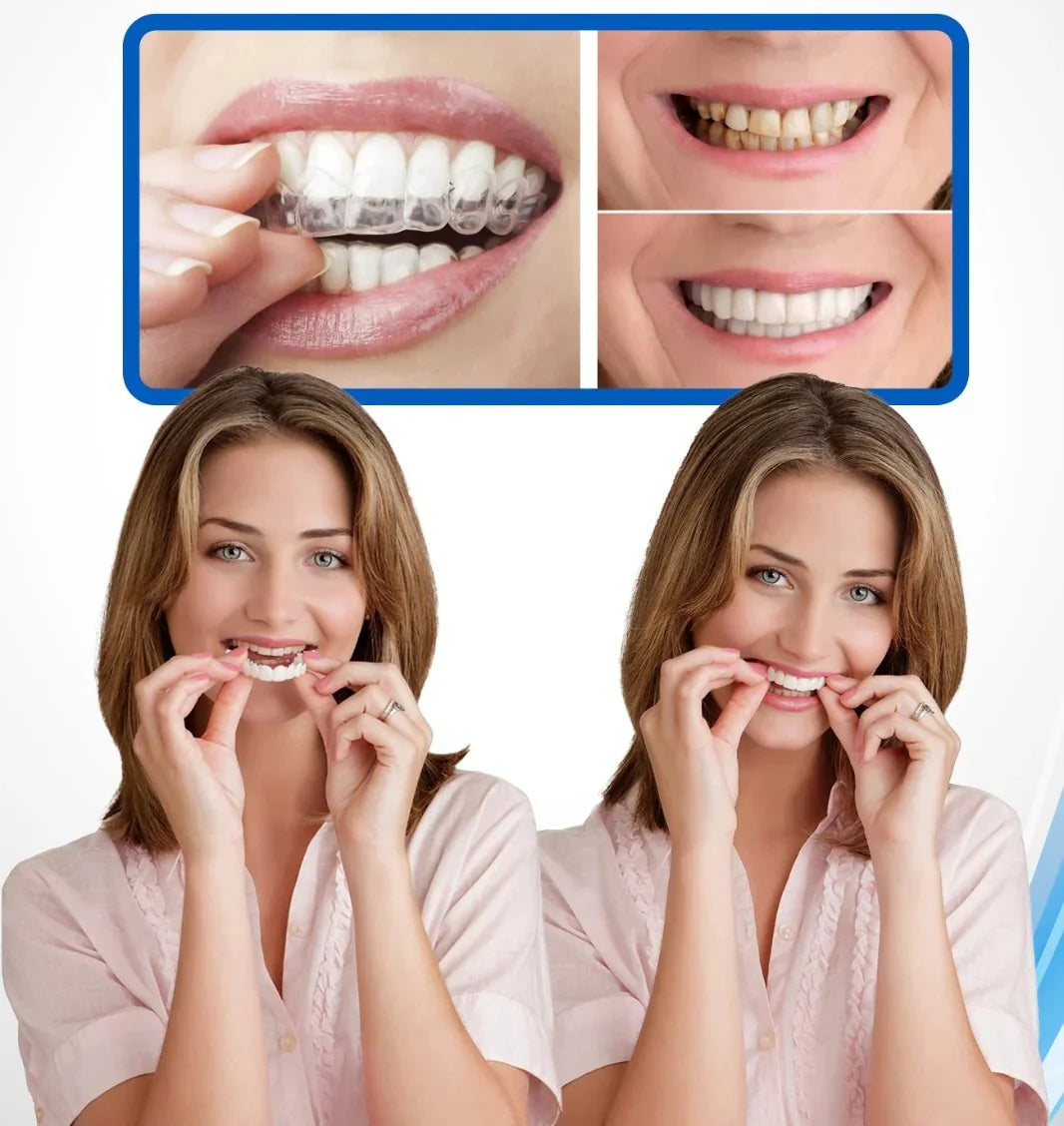 CARILLAS DENTALES